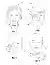 Fig. 05 - Disruption of facial recognition system