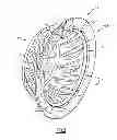 Fig. 04 - Seal land for static structure of a gas turbine engine
