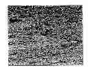 Fig. 01 - TISSUE REPAIR AND REPLACEMENT