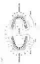 Fig. 02 - Method of arranging artificial teeth