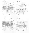 Fig. 06 - Amplification system with spatial separation