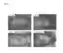 Fig. 07 - Granzyme A and granzyme B diagnostics