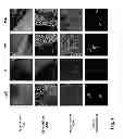 Fig. 02 - Diagnostic Kit as Well as a Metho dfor the Examination of a Human Patient Sample for the Presence of Neuromyelitis Optica-Specific Antibodies