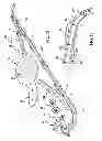 Fig. 09 - Rotating top assembly toy play set and method for launching a rotating top