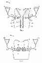 Fig. 02 - WEARABLE RESISTANCE EXERCISE APPARATUS AND METHOD THEREFOR