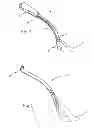 Fig. 02 - Retractor illumination system