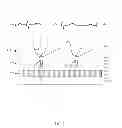 Fig. 09 - METHODS AND SYSTEMS FOR POWER OPTIMIZATION IN A MEDICAL DEVICE