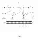 Fig. 10 - METHODS AND SYSTEMS FOR POWER OPTIMIZATION IN A MEDICAL DEVICE