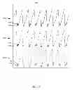 Fig. 30 - METHODS AND SYSTEMS FOR POWER OPTIMIZATION IN A MEDICAL DEVICE