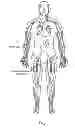 Fig. 02 - Transvascular access methods