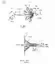 Fig. 17 - Devices and methods for gastrointestinal bypass