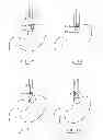 Fig. 23 - Devices and methods for gastrointestinal bypass