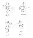 Fig. 26 - Devices and methods for gastrointestinal bypass