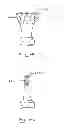 Fig. 34 - Devices and methods for gastrointestinal bypass