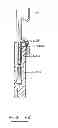 Fig. 43 - Devices and methods for gastrointestinal bypass