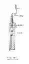 Fig. 45 - Devices and methods for gastrointestinal bypass
