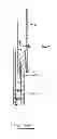 Fig. 46 - Devices and methods for gastrointestinal bypass