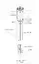 Fig. 02 - Devices and methods for gastrointestinal bypass