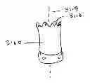Fig. 01 - Devices and methods for gastrointestinal bypass