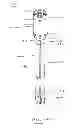 Fig. 02 - Devices and methods for gastrointestinal bypass