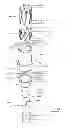 Fig. 11 - Devices and methods for gastrointestinal bypass