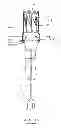 Fig. 12 - Devices and methods for gastrointestinal bypass