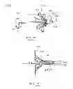 Fig. 17 - Devices and methods for gastrointestinal bypass