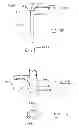 Fig. 27 - Devices and methods for gastrointestinal bypass