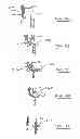 Fig. 32 - Devices and methods for gastrointestinal bypass