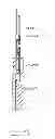Fig. 41 - Devices and methods for gastrointestinal bypass
