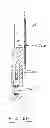 Fig. 46 - Devices and methods for gastrointestinal bypass