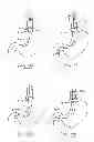 Fig. 52 - Devices and methods for gastrointestinal bypass