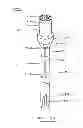 Fig. 06 - DEVICES AND METHODS FOR GASTROINTESTINAL BYPASS