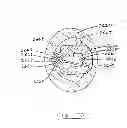 Fig. 41 - DEVICES AND METHODS FOR GASTROINTESTINAL BYPASS