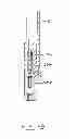 Fig. 43 - DEVICES AND METHODS FOR GASTROINTESTINAL BYPASS