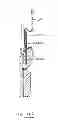 Fig. 45 - DEVICES AND METHODS FOR GASTROINTESTINAL BYPASS