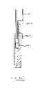 Fig. 46 - DEVICES AND METHODS FOR GASTROINTESTINAL BYPASS