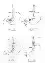 Fig. 48 - DEVICES AND METHODS FOR GASTROINTESTINAL BYPASS