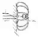 Fig. 01 - Devices and methods for gastrointestinal bypass