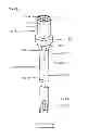 Fig. 06 - Devices and methods for gastrointestinal bypass