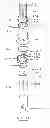 Fig. 07 - Devices and methods for gastrointestinal bypass