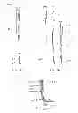 Fig. 32 - Devices and methods for gastrointestinal bypass