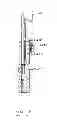 Fig. 44 - Devices and methods for gastrointestinal bypass