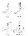 Fig. 53 - Devices and methods for gastrointestinal bypass