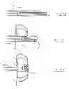 Fig. 67 - Devices and methods for gastrointestinal bypass