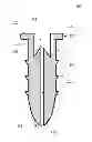Fig. 01 - Nasolacrimal plugs