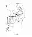 Fig. 07 - Implantable drug delivery device and methods