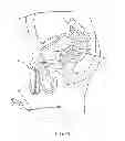 Fig. 08 - Implantable drug delivery device and methods