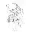 Fig. 09 - Implantable drug delivery device and methods