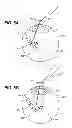 Fig. 09 - DRUG DELIVERY DEVICES, KITS, AND METHODS THEREFOR